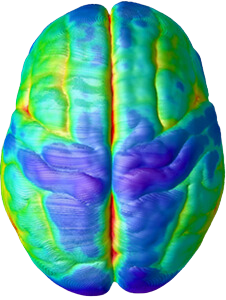 Brain at age 15