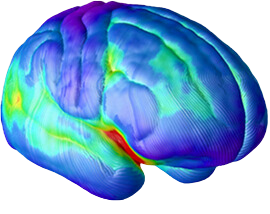 Side Brain at age 20