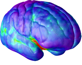 Side Brain at age 25